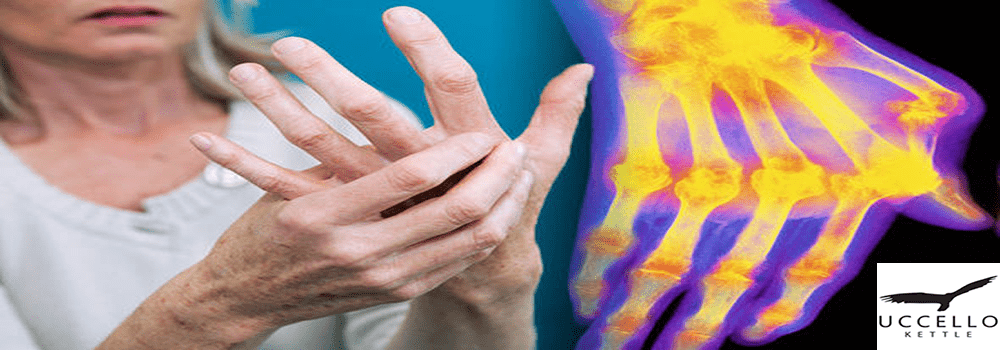 Hand and Wrist Arthritis